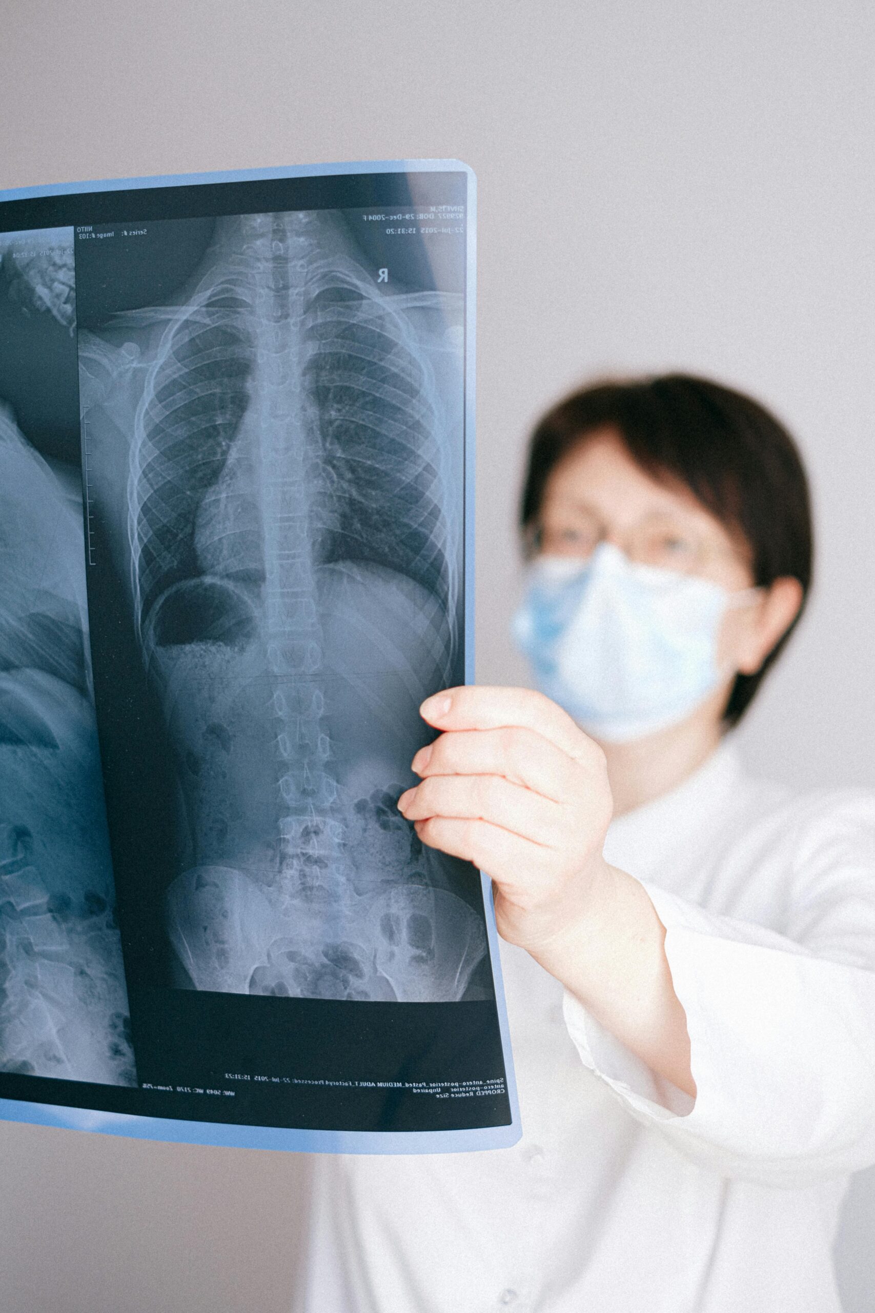A medical professional wearing a mask examines an X-ray in a clinical setting.